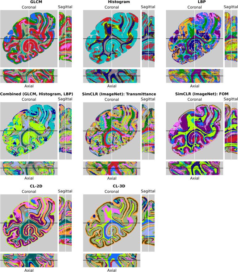 https://cdn.ncbi.nlm.nih.gov/pmc/blobs/eff3/12290659/17e515891a35/imag_a_00351_fig14.jpg