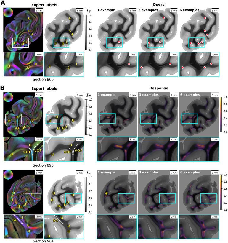 https://cdn.ncbi.nlm.nih.gov/pmc/blobs/eff3/12290659/415ed7015a73/imag_a_00351_fig11.jpg
