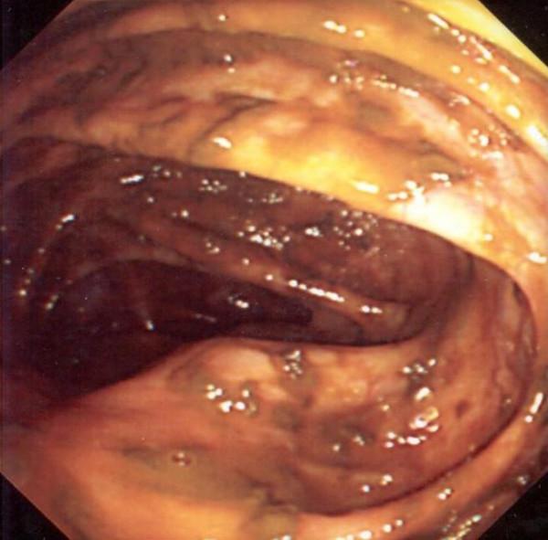 https://cdn.ncbi.nlm.nih.gov/pmc/blobs/f004/2277416/10d714219d0a/1477-7819-6-23-2.jpg