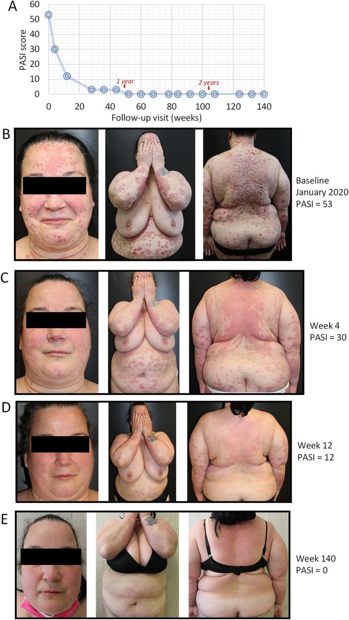 https://cdn.ncbi.nlm.nih.gov/pmc/blobs/f014/10831554/88752b1f50a3/SKI2-4-e289-g002.jpg