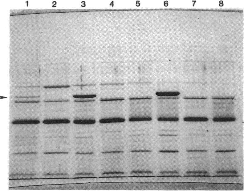 https://cdn.ncbi.nlm.nih.gov/pmc/blobs/f014/192396/33023116dfdf/aac00033-0156-a.jpg