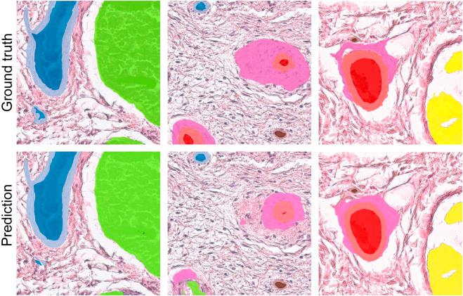 https://cdn.ncbi.nlm.nih.gov/pmc/blobs/f015/11233802/91878a6ce43e/fbioe-12-1411680-g005.jpg