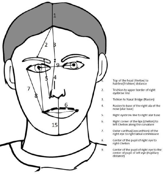 https://cdn.ncbi.nlm.nih.gov/pmc/blobs/f016/5927504/4ca4c57243cf/OAMJMS-6-680-g001.jpg