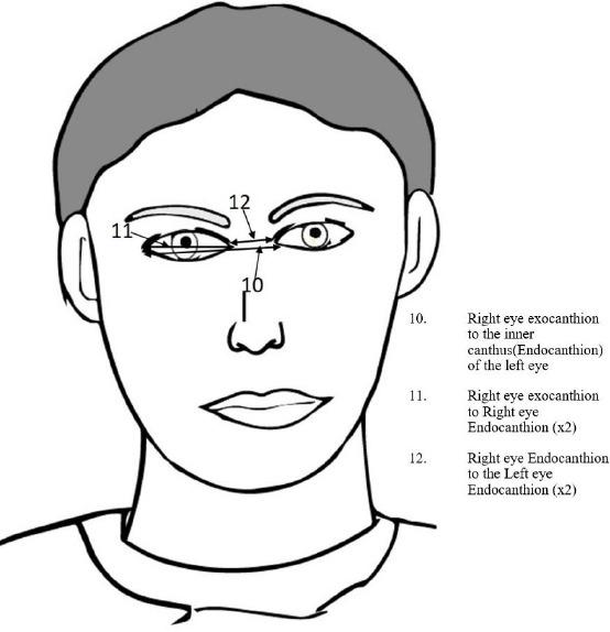 https://cdn.ncbi.nlm.nih.gov/pmc/blobs/f016/5927504/91249e7454e0/OAMJMS-6-680-g002.jpg