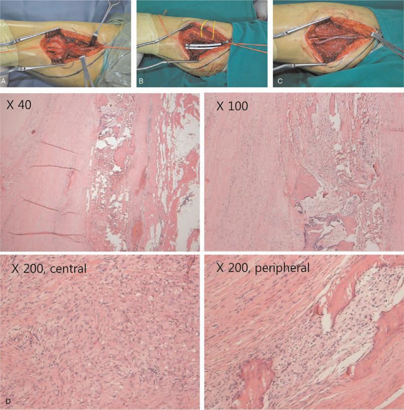 https://cdn.ncbi.nlm.nih.gov/pmc/blobs/f01c/7581180/be41fb09dd91/medi-99-e22810-g004.jpg