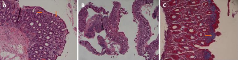 https://cdn.ncbi.nlm.nih.gov/pmc/blobs/f02d/12264809/9b4e2ed739a1/wjge-17-7-106208-g002.jpg