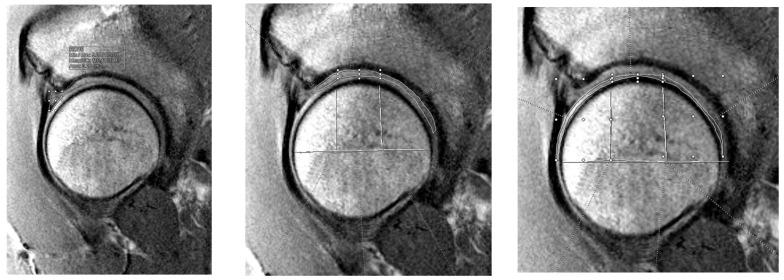 https://cdn.ncbi.nlm.nih.gov/pmc/blobs/f02e/12387705/15858c2bfab1/jimaging-11-00261-g002.jpg