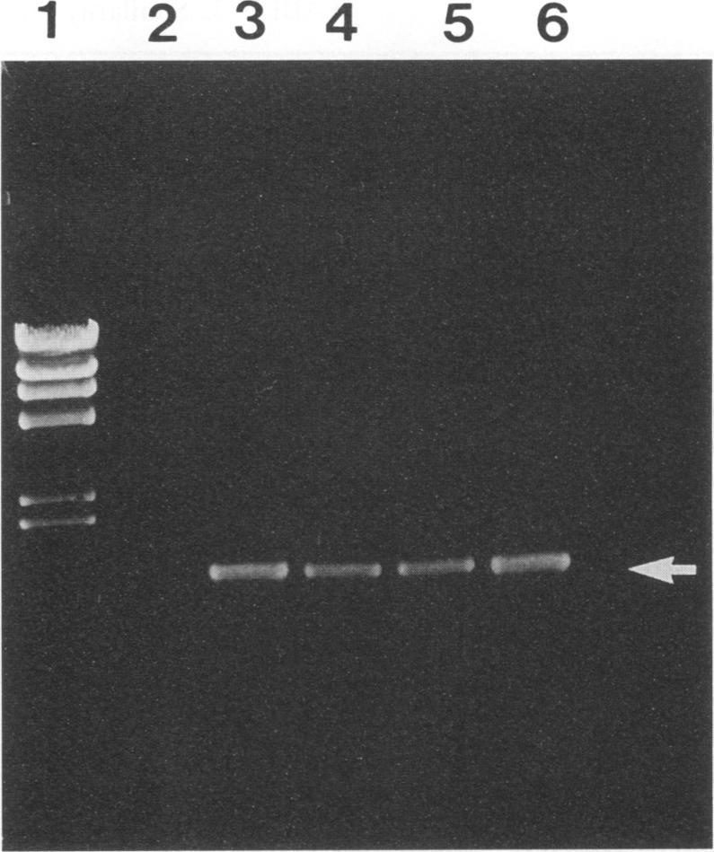 https://cdn.ncbi.nlm.nih.gov/pmc/blobs/f03a/263654/3dbbe246e30d/jcm00005-0111-a.jpg