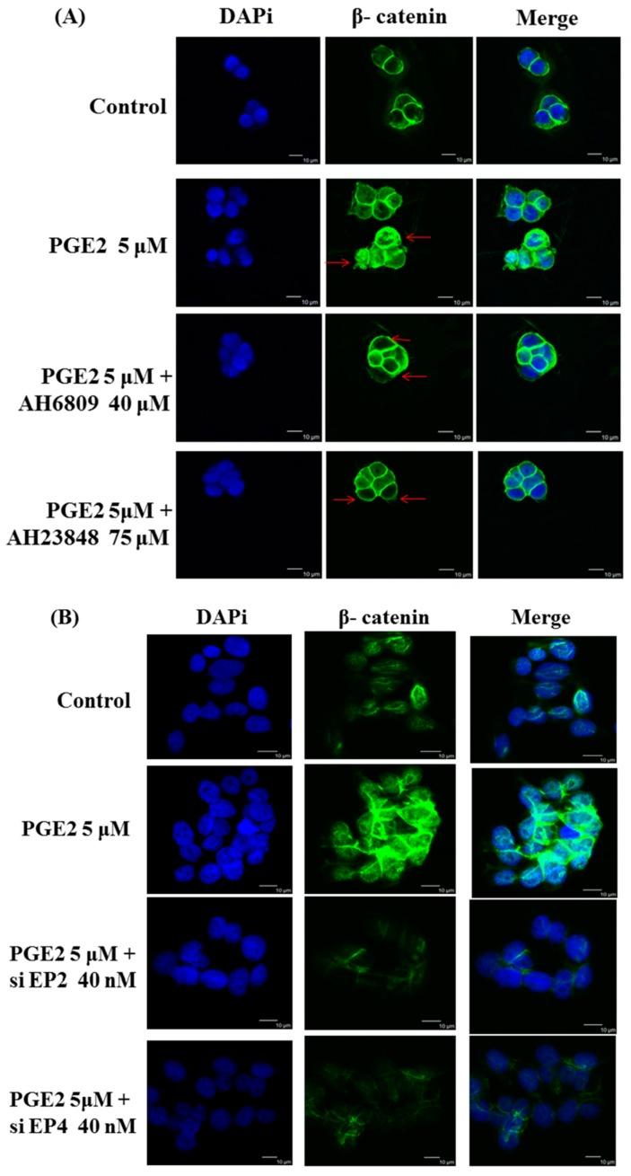 https://cdn.ncbi.nlm.nih.gov/pmc/blobs/f03f/5485956/12a17ed27761/ijms-18-01132-g004a.jpg