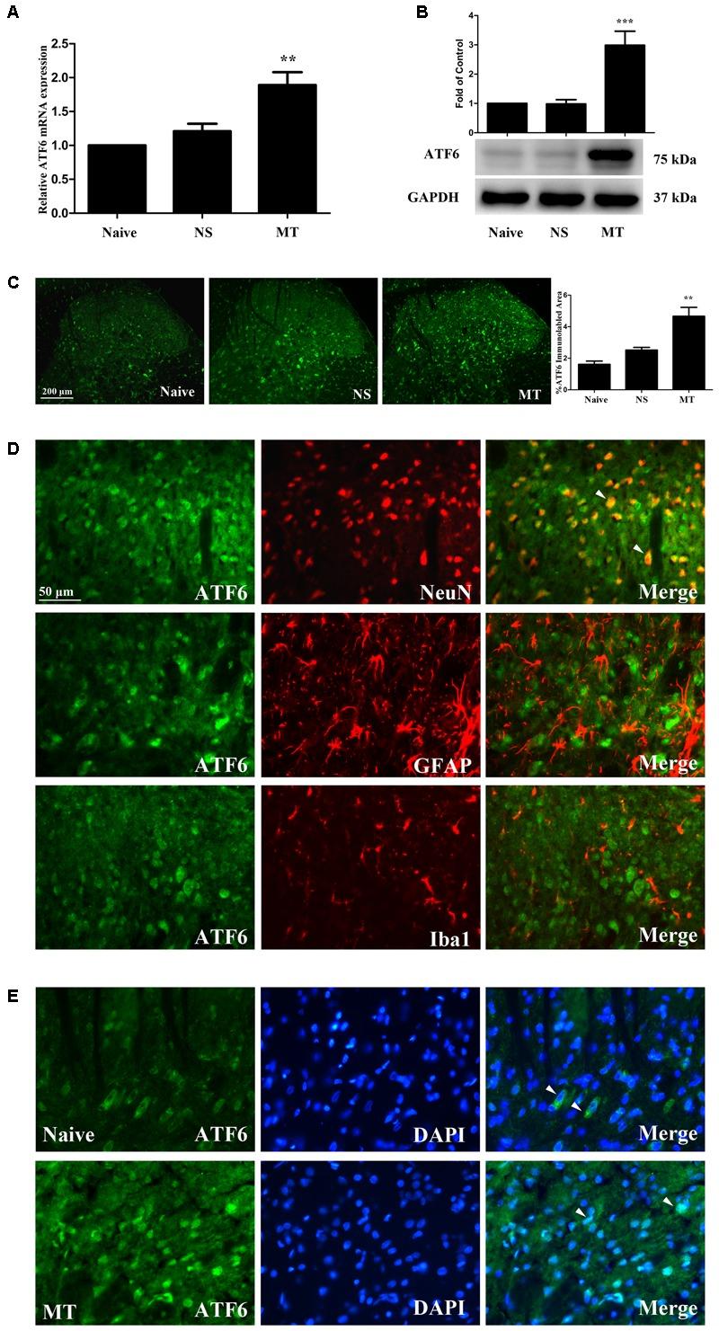 https://cdn.ncbi.nlm.nih.gov/pmc/blobs/f04a/5845556/bf63f2eae9cd/fnmol-11-00072-g008.jpg