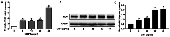 https://cdn.ncbi.nlm.nih.gov/pmc/blobs/f050/8193207/1323587a460f/etm-22-02-10247-g00.jpg