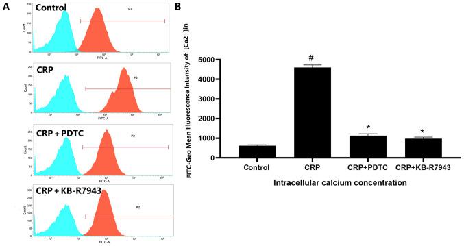https://cdn.ncbi.nlm.nih.gov/pmc/blobs/f050/8193207/a10e476a282e/etm-22-02-10247-g03.jpg