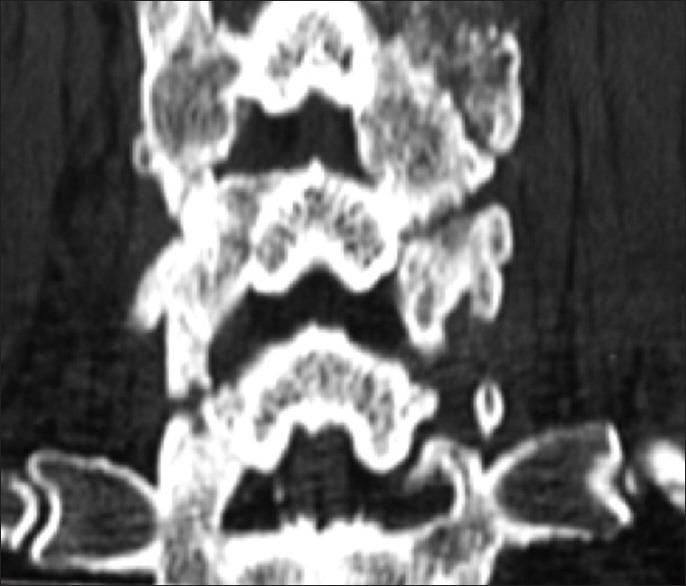 https://cdn.ncbi.nlm.nih.gov/pmc/blobs/f051/4431045/533b07da3ef0/SNI-6-164-g005.jpg