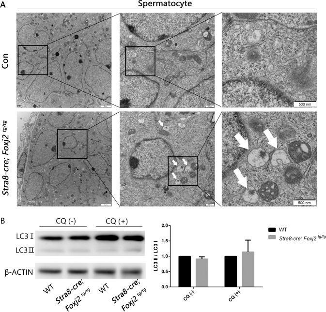 https://cdn.ncbi.nlm.nih.gov/pmc/blobs/f054/9338950/bd65133f0360/41419_2022_5116_Fig6_HTML.jpg
