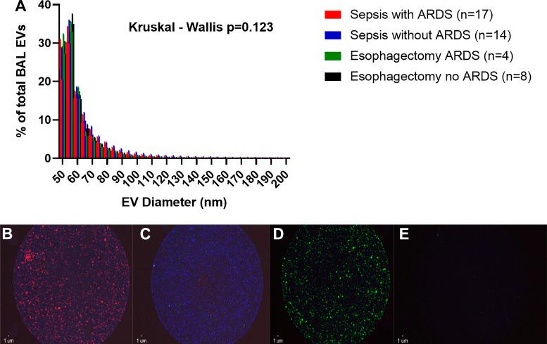 https://cdn.ncbi.nlm.nih.gov/pmc/blobs/f055/8993517/4a44d120ccb6/ajplung.00052.2022_f001.jpg