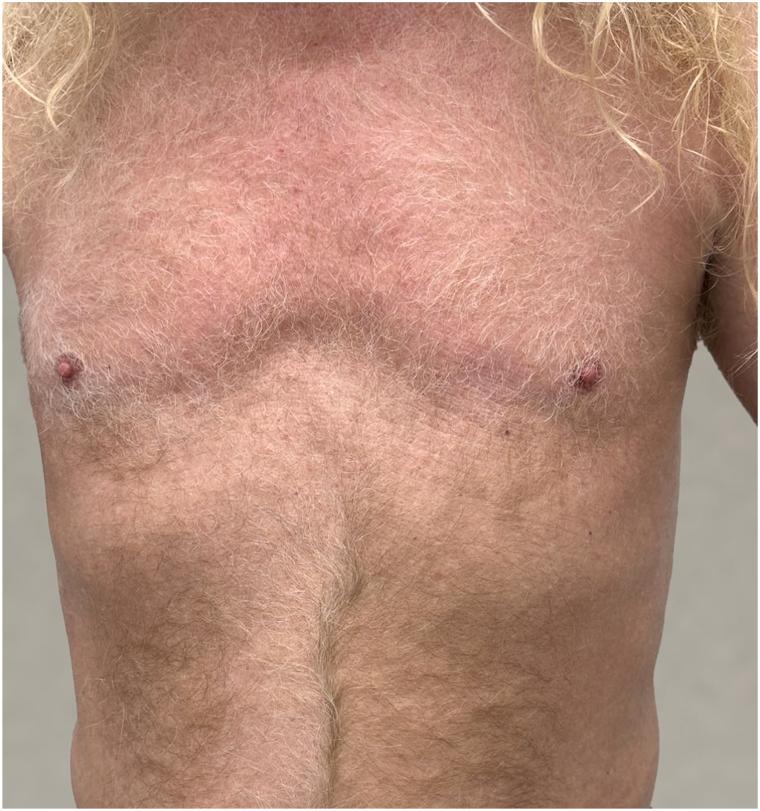 https://cdn.ncbi.nlm.nih.gov/pmc/blobs/f05d/12063010/013ac46c2bdc/gr4.jpg
