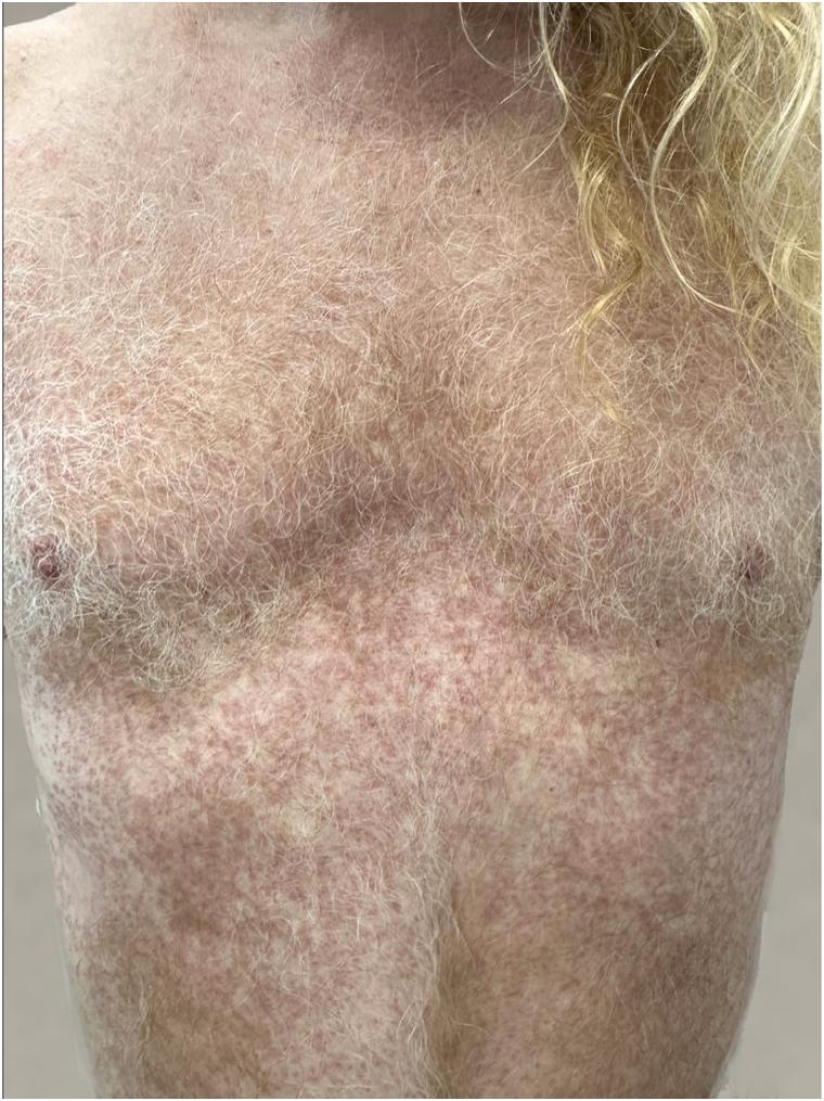 https://cdn.ncbi.nlm.nih.gov/pmc/blobs/f05d/12063010/4c96ad33b821/gr2.jpg