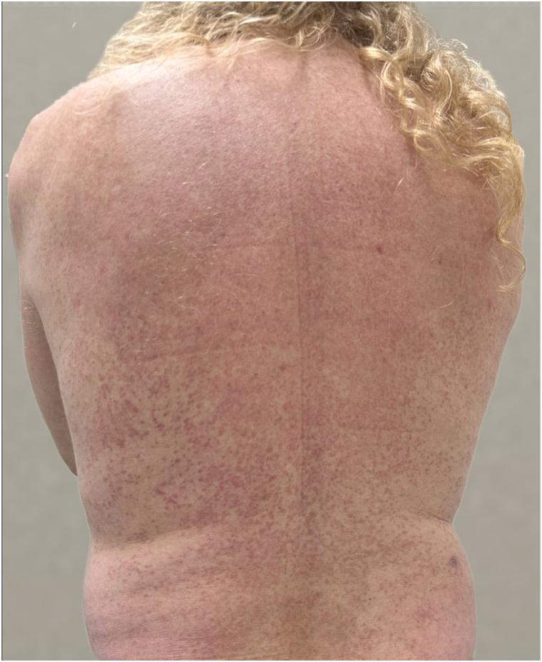 https://cdn.ncbi.nlm.nih.gov/pmc/blobs/f05d/12063010/b5b1fd0af6de/gr1.jpg