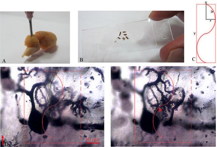 https://cdn.ncbi.nlm.nih.gov/pmc/blobs/f060/3897687/08b4c80c15fc/en-22-258-g002.jpg