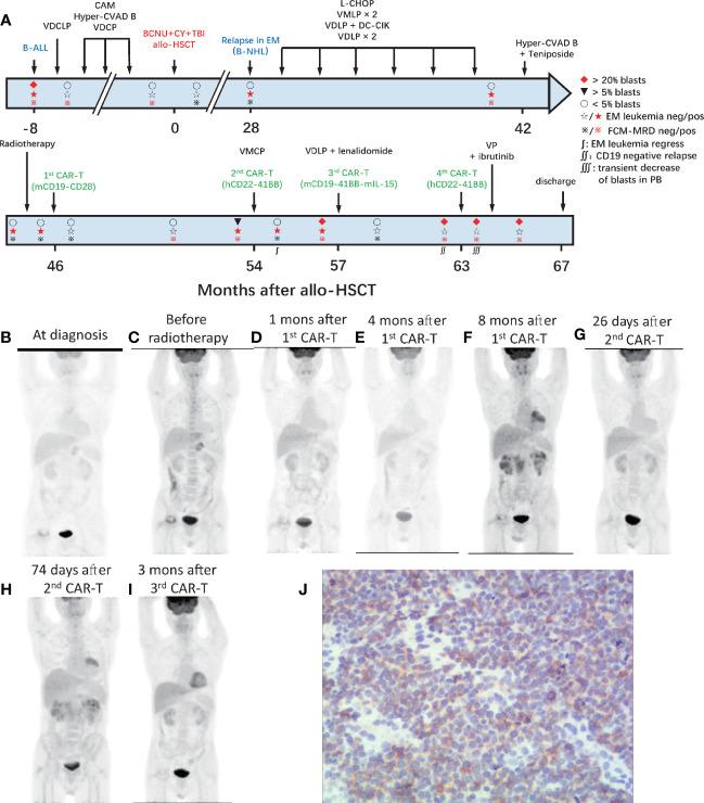 https://cdn.ncbi.nlm.nih.gov/pmc/blobs/f060/8530183/fb3a9f1bda65/fimmu-12-728962-g001.jpg