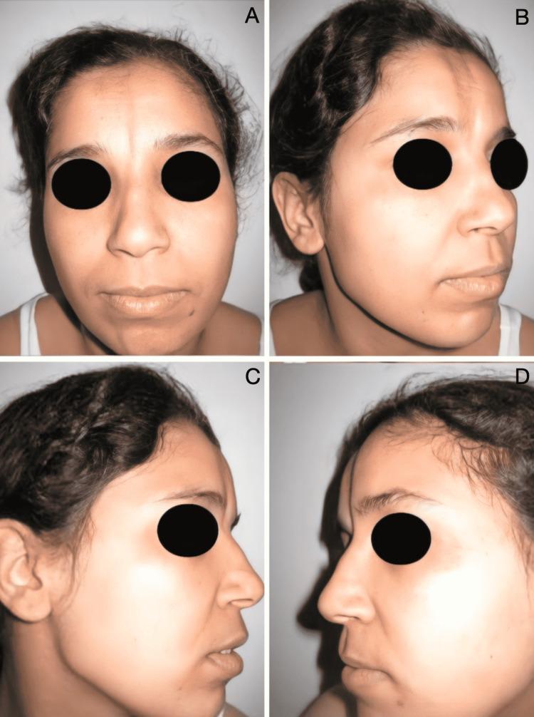 https://cdn.ncbi.nlm.nih.gov/pmc/blobs/f067/9665929/7dc6c053751e/cureus-0014-00000030358-i03.jpg