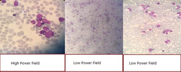https://cdn.ncbi.nlm.nih.gov/pmc/blobs/f06a/7869390/08412a30a959/CCR3-9-605-g001.jpg