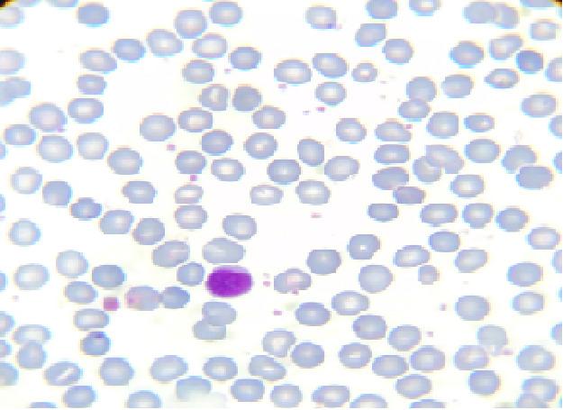 https://cdn.ncbi.nlm.nih.gov/pmc/blobs/f06a/7869390/9ecbebb9a59b/CCR3-9-605-g005.jpg