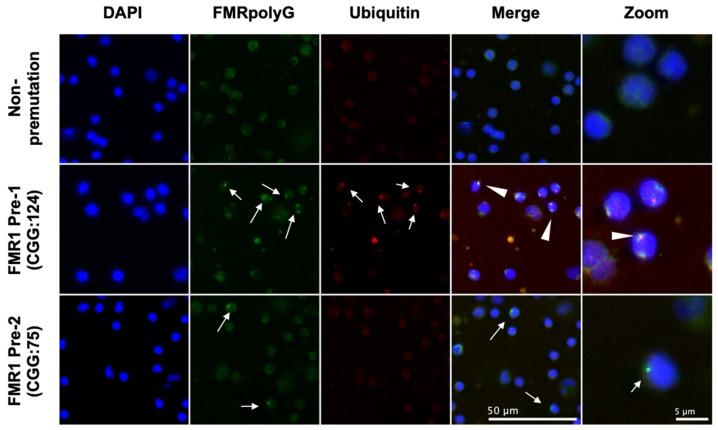 https://cdn.ncbi.nlm.nih.gov/pmc/blobs/f074/8951797/fc8b6379bc05/genes-13-00451-g001.jpg