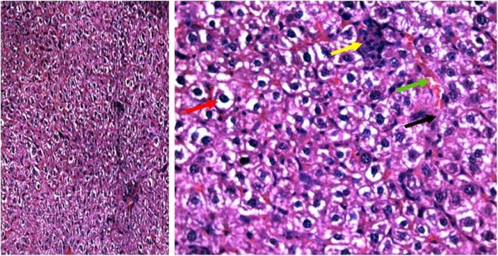 https://cdn.ncbi.nlm.nih.gov/pmc/blobs/f07f/6170219/50ea74b191a8/pl2.jpg
