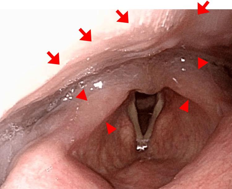 https://cdn.ncbi.nlm.nih.gov/pmc/blobs/f08a/10257532/97b43b47a9d5/cureus-0015-00000038905-i04.jpg