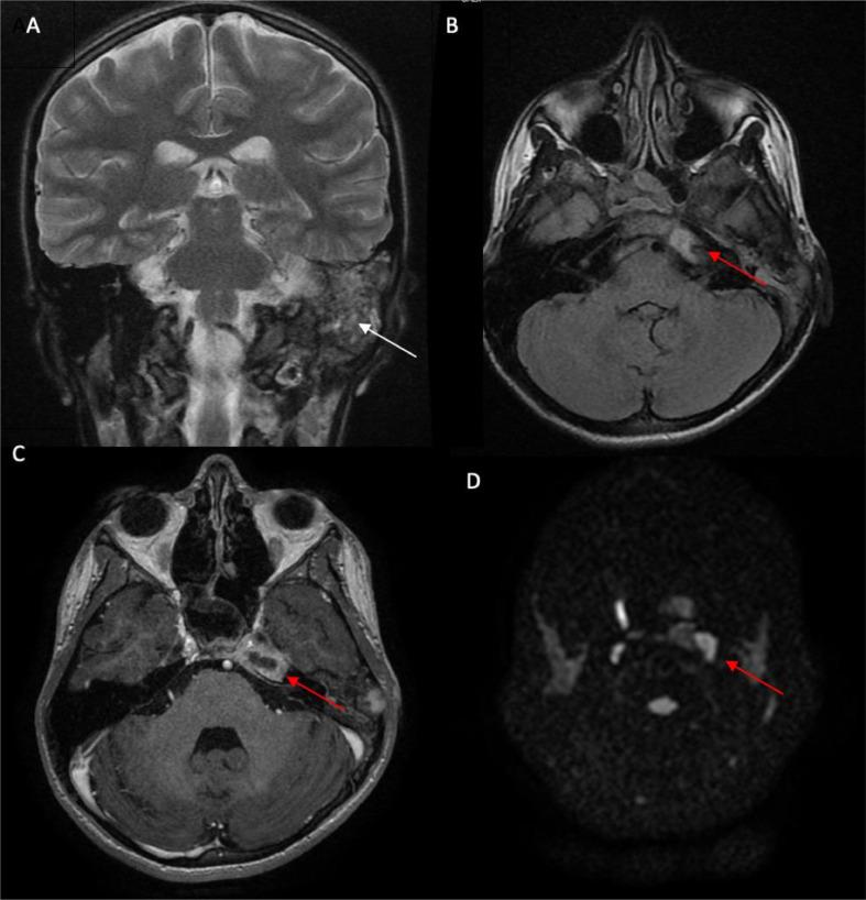 https://cdn.ncbi.nlm.nih.gov/pmc/blobs/f08d/11403888/0b6d27cee4bc/gr2.jpg