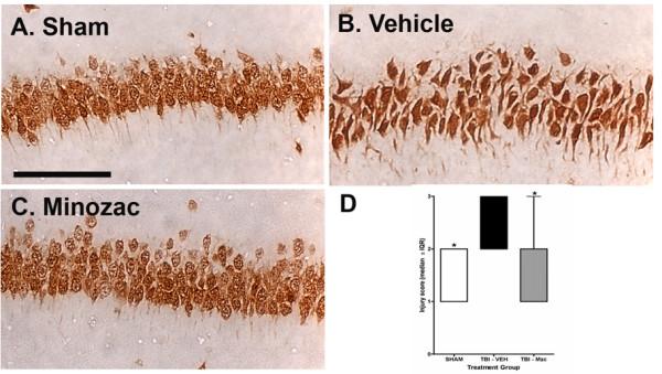 https://cdn.ncbi.nlm.nih.gov/pmc/blobs/f08d/2483713/aa00564a7a22/1742-2094-5-28-6.jpg