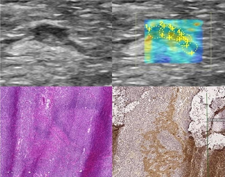 https://cdn.ncbi.nlm.nih.gov/pmc/blobs/f08e/8959156/af89d21b1928/pone.0265802.g003.jpg