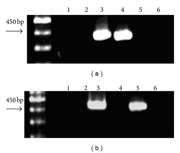 https://cdn.ncbi.nlm.nih.gov/pmc/blobs/f09e/3690203/fee36a0608bb/BMRI2013-136492.004.jpg