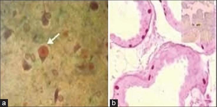 https://cdn.ncbi.nlm.nih.gov/pmc/blobs/f0a0/4001222/d317064a01ac/AIAN-17-3-g003.jpg