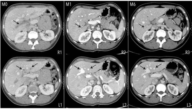 https://cdn.ncbi.nlm.nih.gov/pmc/blobs/f0a0/5412551/2264a6cccaa9/gr-10-141-g001.jpg
