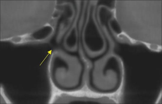 https://cdn.ncbi.nlm.nih.gov/pmc/blobs/f0a1/7814679/d5c88e31dc9a/JIPS-20-371-g008.jpg