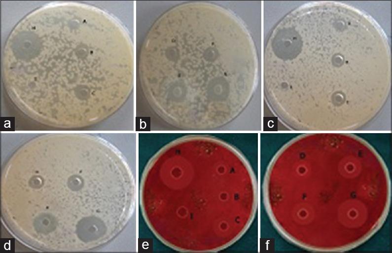 https://cdn.ncbi.nlm.nih.gov/pmc/blobs/f0a3/5799984/7fa8f3132e1d/JCD-20-398-g002.jpg