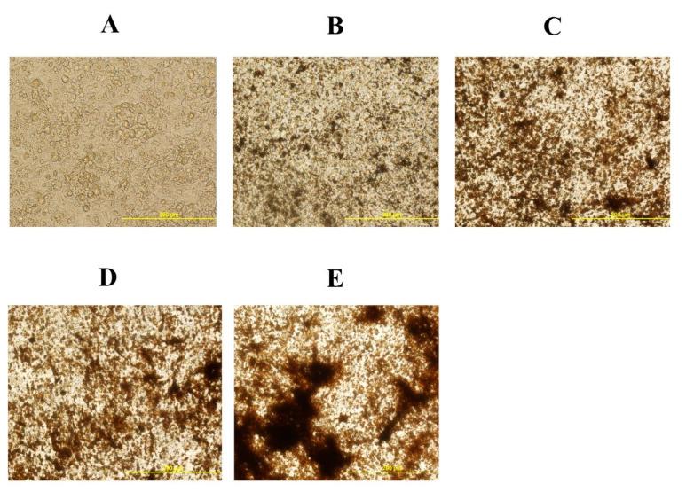 https://cdn.ncbi.nlm.nih.gov/pmc/blobs/f0a5/7698591/19342f817ff5/genes-11-01360-g002.jpg