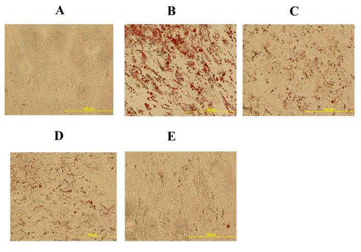 https://cdn.ncbi.nlm.nih.gov/pmc/blobs/f0a5/7698591/b831f2affd21/genes-11-01360-g005.jpg