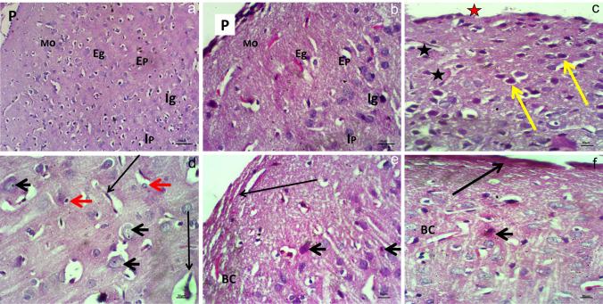 https://cdn.ncbi.nlm.nih.gov/pmc/blobs/f0ab/11978713/558136c53a0a/210_2024_3512_Fig7_HTML.jpg