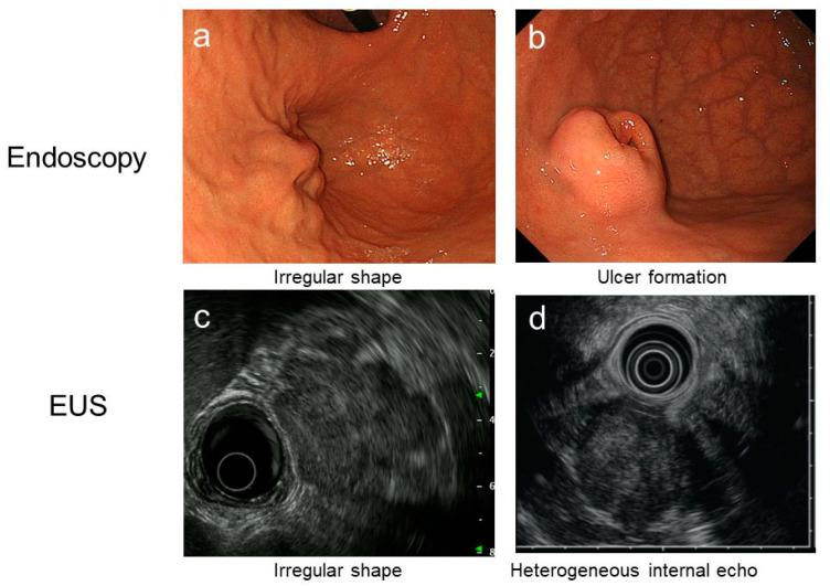 https://cdn.ncbi.nlm.nih.gov/pmc/blobs/f0ae/8268322/d3dff139cf97/cancers-13-03158-g003.jpg