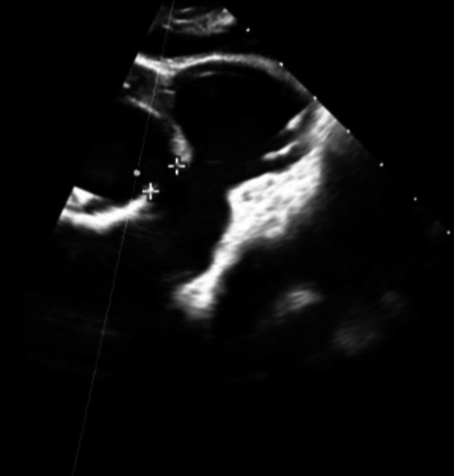 https://cdn.ncbi.nlm.nih.gov/pmc/blobs/f0b5/12344374/618cc9065a07/CCR3-13-e70613-g002.jpg