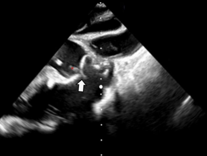 https://cdn.ncbi.nlm.nih.gov/pmc/blobs/f0b5/12344374/cd4ad52502dd/CCR3-13-e70613-g005.jpg