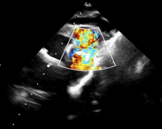https://cdn.ncbi.nlm.nih.gov/pmc/blobs/f0b5/12344374/cea942dc9ed7/CCR3-13-e70613-g003.jpg