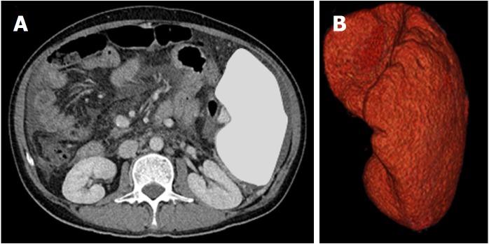 https://cdn.ncbi.nlm.nih.gov/pmc/blobs/f0b7/6295839/084fcf911606/WJG-24-5271-g001.jpg