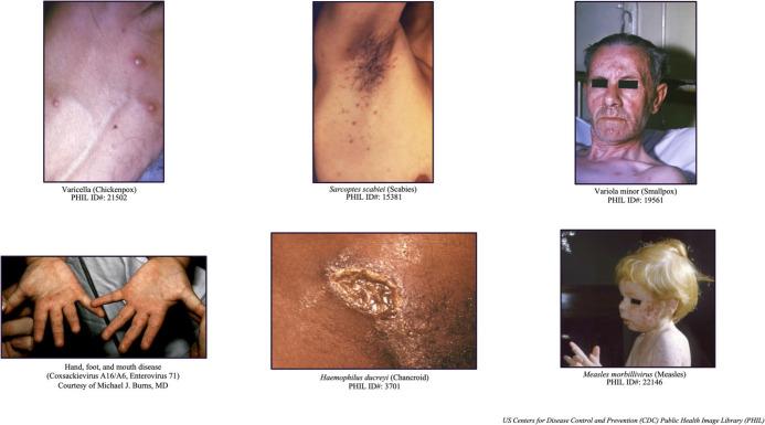 https://cdn.ncbi.nlm.nih.gov/pmc/blobs/f0b9/9470524/3b94dda148c6/S1049023X22001121_fig3.jpg