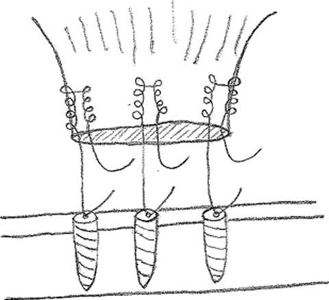 https://cdn.ncbi.nlm.nih.gov/pmc/blobs/f0ba/6378447/5c3c94d4538f/10.1177_2325967118824551-fig2.jpg