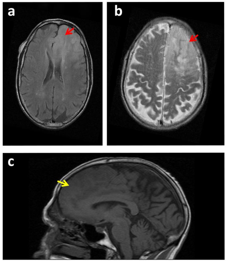 https://cdn.ncbi.nlm.nih.gov/pmc/blobs/f0bc/8750680/c7ce8efdbdf7/cancers-14-00074-g002.jpg