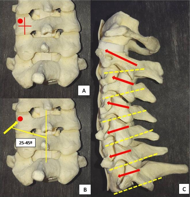 https://cdn.ncbi.nlm.nih.gov/pmc/blobs/f0bd/6232718/591b7a1fe7d6/10.1177_2192568218759940-fig8.jpg
